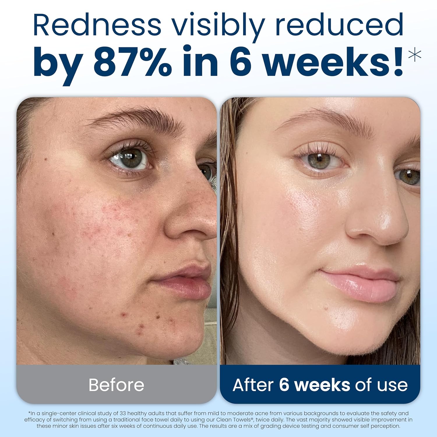 Clean Skin Club Clean Towels XL, 100% USDA Biobased Dermatologist Approved Face Towel, Disposable Clinically Tested Face Towelette, Makeup Remover... - Image 4