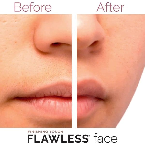 Finishing Touch Flawless Women's Painless Hair Remover , White/Rose Gold - Image 5